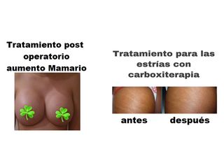 tratamientos post operatorios