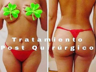 Post Quirúrgico