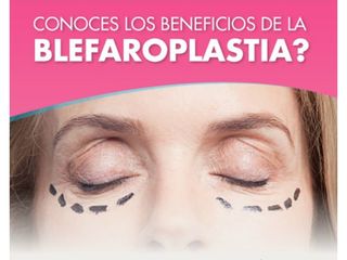 Blefaroplastia