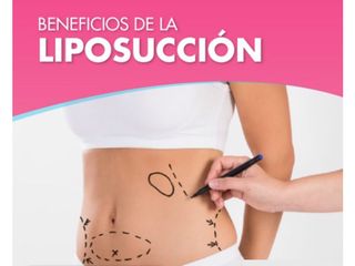 Liposuccion