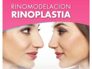 Rinoplastia