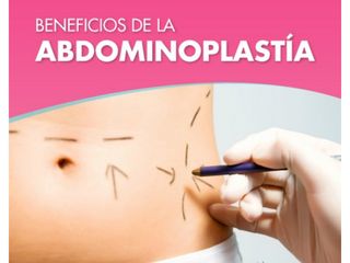 Abdominoplastia