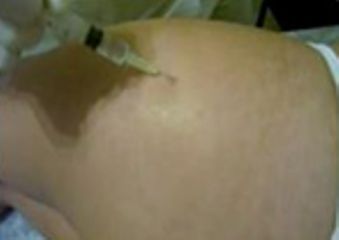 Estética corporal