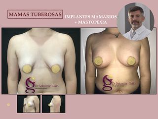Dr. Sebastián Gallo