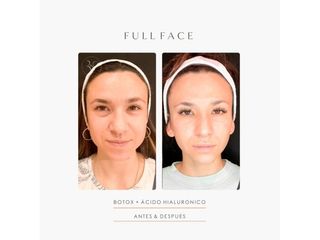 Dra. Romina Neira - Fullface