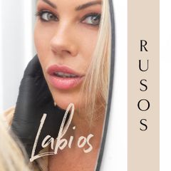 Labios rusos