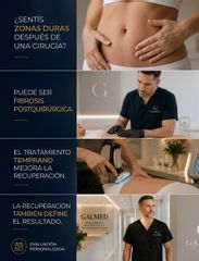 Fibrosis postquirúrgica: qué es, por qué aparece y cómo puede tratarse - Galeazzo Cirugia & Estetic