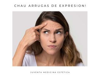 Arrugas de expresión