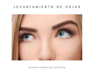 Levantamiento de cejas