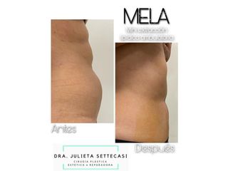 Mela - Dra. Julieta Settecasi