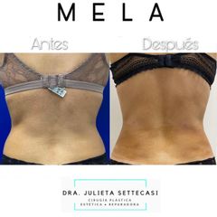 MELA - Dra. Julieta Settecasi