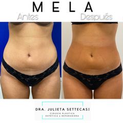 MELA - Dra. Julieta Settecasi