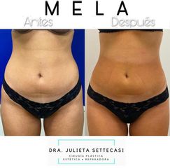 MELA - Dra. Julieta Settecasi