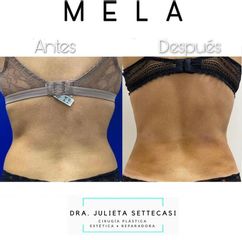 MELA - Dra. Julieta Settecasi