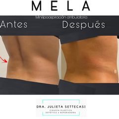 MELA - Dra. Julieta Settecasi