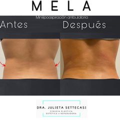 MELA - Dra. Julieta Settecasi