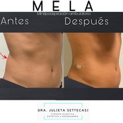 MELA - Dra. Julieta Settecasi