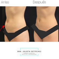 MELA - Dra. Julieta Settecasi