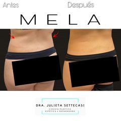 MELA - Dra. Julieta Settecasi