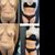 cirugia abdominiplastia de excelencia