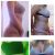 Lipo de abdomen, flancos y espalda baja. 