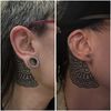 Reducción de oreja, cierre de lóbulo por expansor