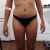 Me he aumentado los glúteos ya que no tenía nada con método lipotranferencia
