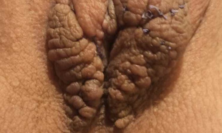 141153