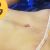 Meta cumplida!😊me hice una abdominoplastia