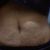 Estoy decidida a hacerme una abdominoplastia