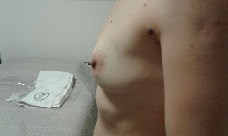 61620