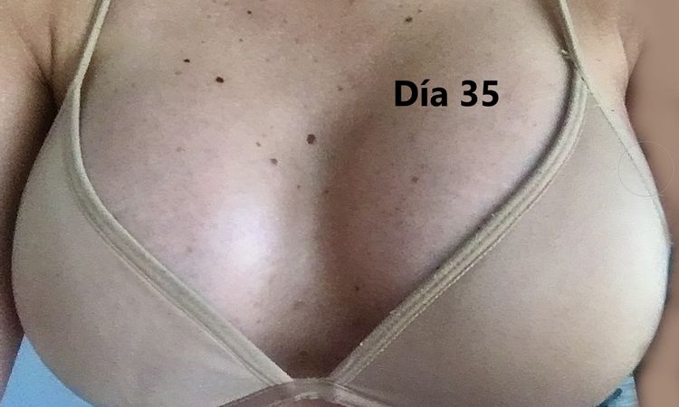 74480