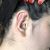 Cirugía de orejas prominentes