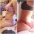 Lipoescultura con dermolipectomía en espalda