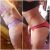 Lipoescultura con dermolipectomía en espalda