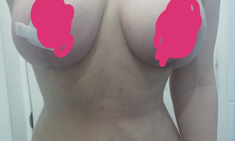 71218