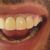 Mis dientes más blancos y brillantes