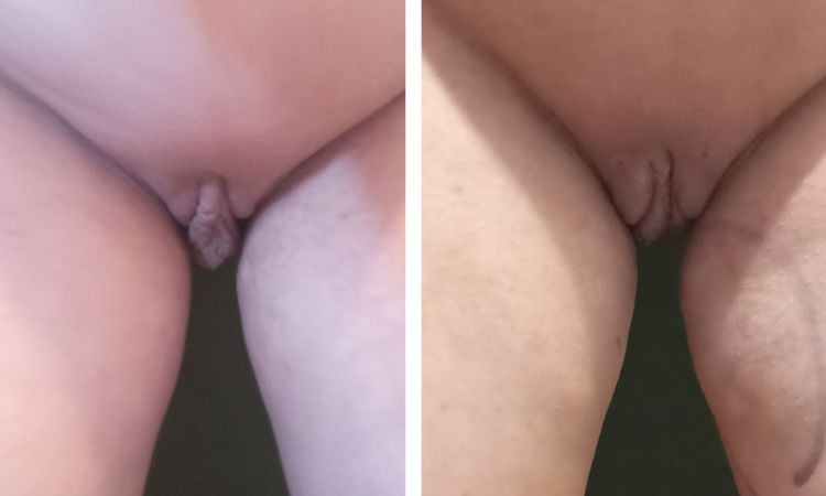 140913