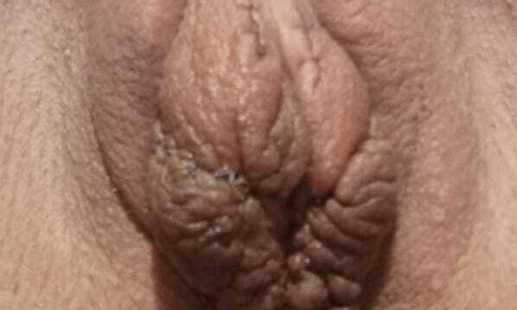 141009