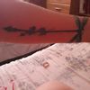 Quiero quitarme un tatuaje.