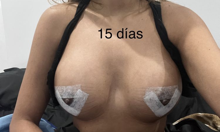 141161