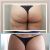 Mesoterapia, Increíble experiencia!!