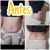 Mi Experiencia con mi abdominoplastia