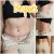 Mi Experiencia con mi abdominoplastia