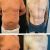 Lipoescultura, excelente profesional