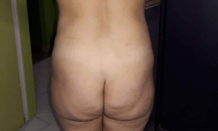 70818