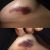 Aparición de hematoma 