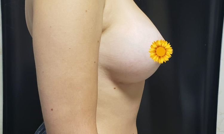 6411