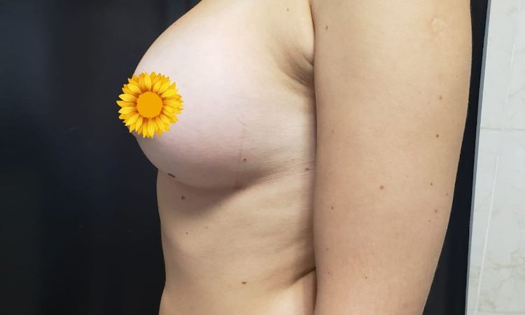 6412