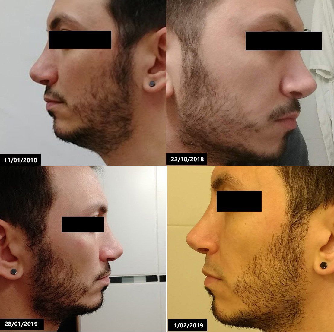 6808